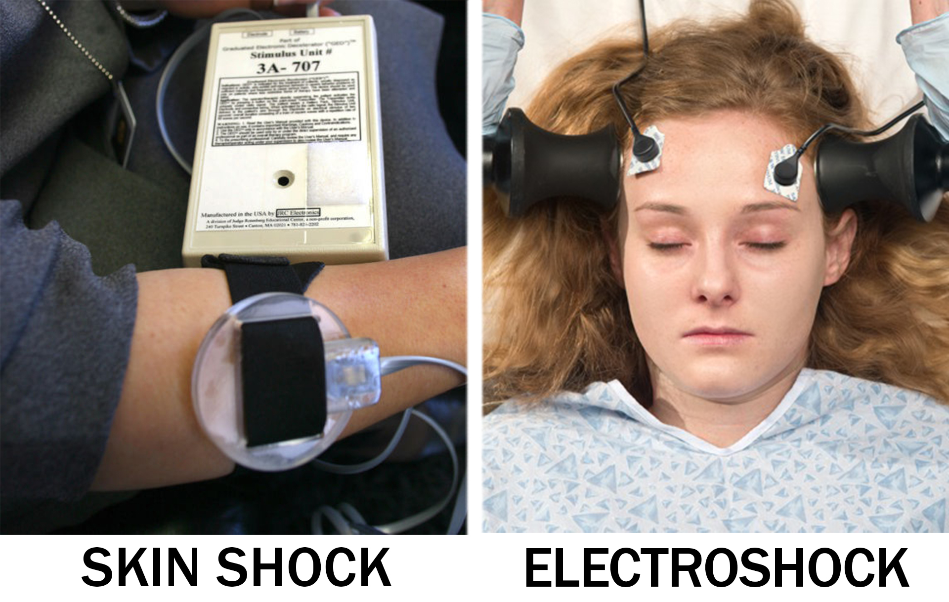 F.D.A. Is Studying the Risk of Electroshock Devices